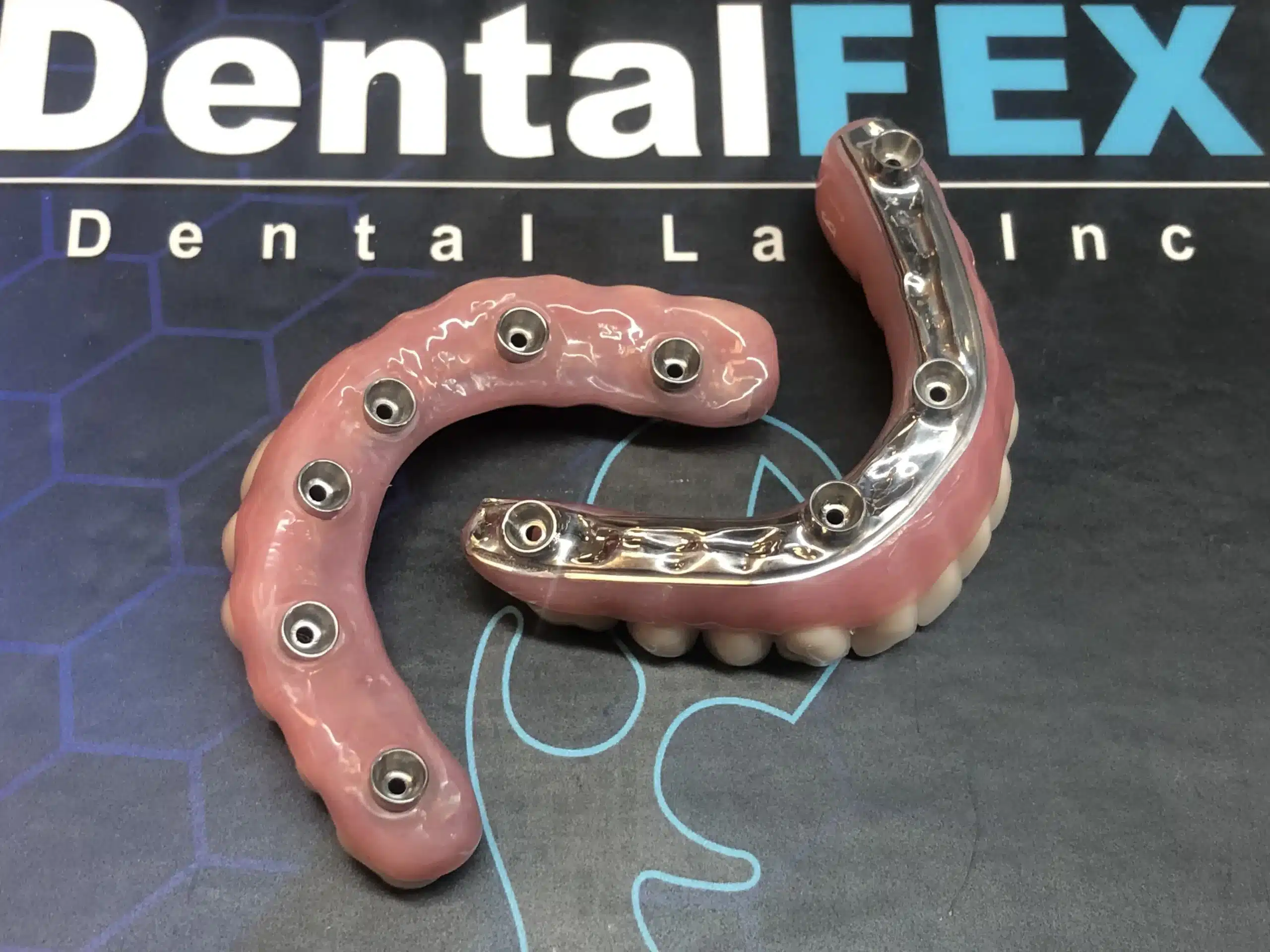DentalFEX