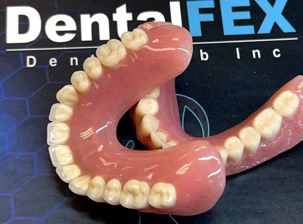 DentalFEX