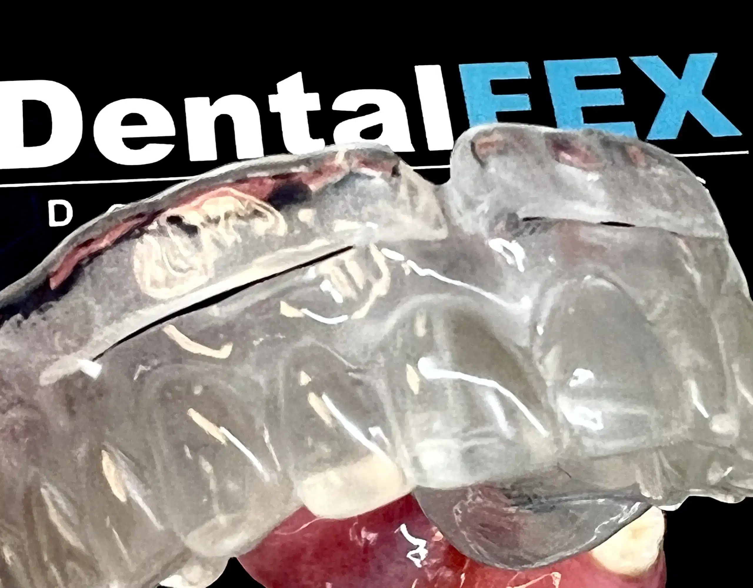 DentalFEX